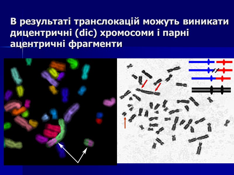 В результаті транслокацій можуть виникати дицентричні (dic) хромосоми і парні ацентричні фрагменти